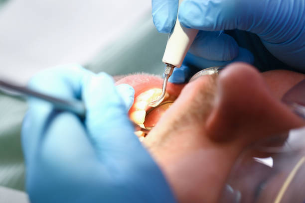 Best Emergency Broken Tooth Repair in Townsend, DE