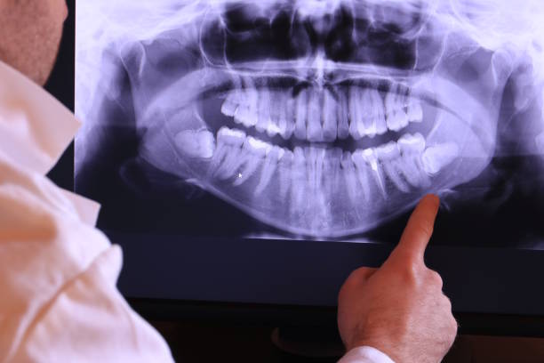 Best Emergency Tooth Extraction in Townsend, DE